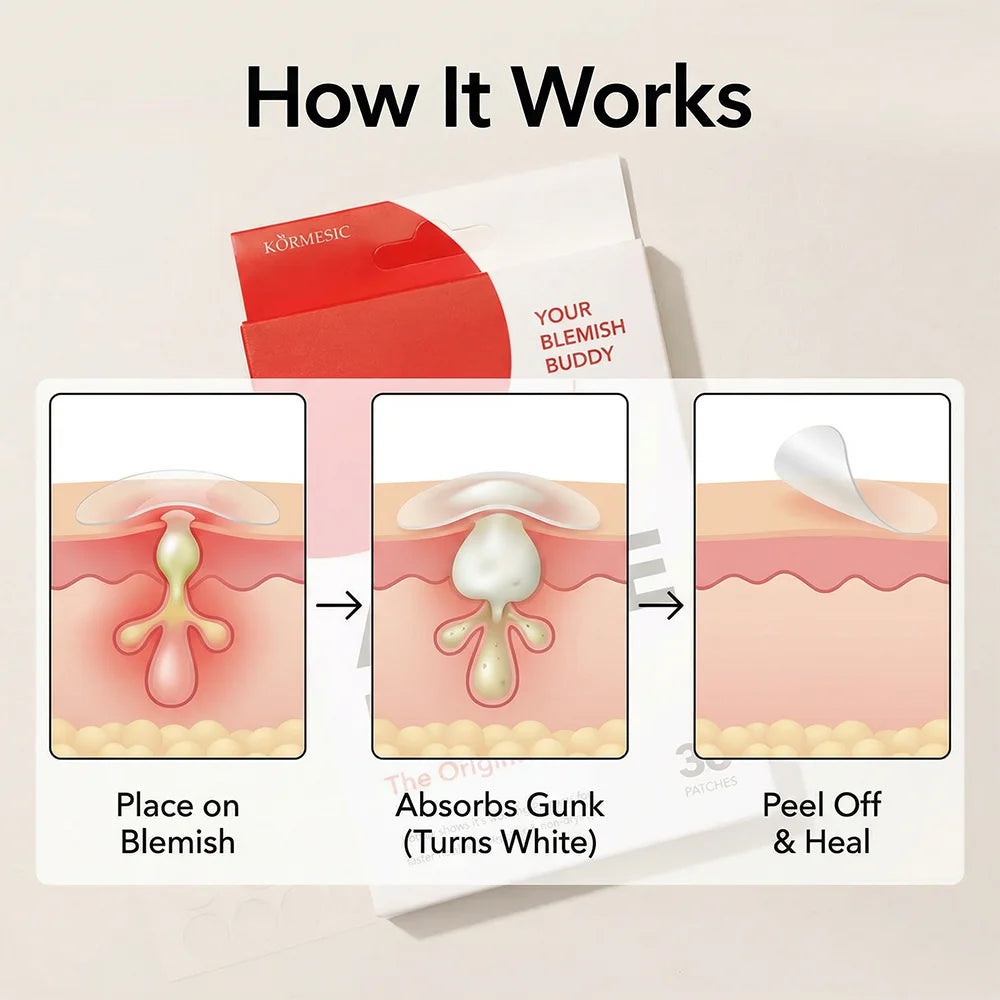 36pcs Hydrocolloid Acne Patches Invisible Pimple Patches for Face Absorb Pus Oil Reduce Redness Zit Stickers All Day Invisible