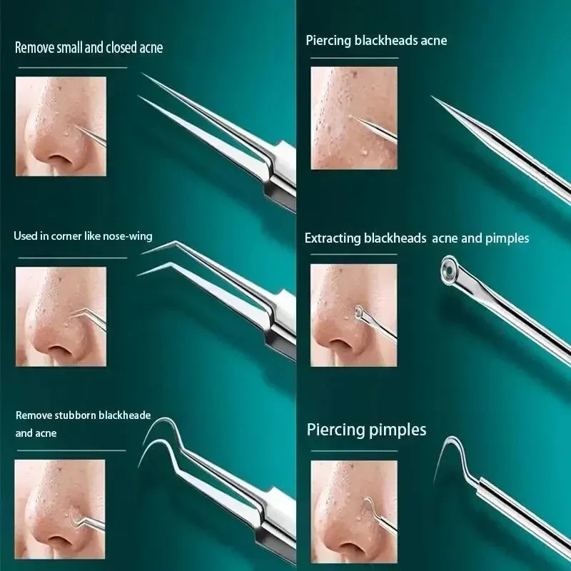 11pcs Acne Blackhead Removal Needles Kit Black Spot Blemish Pimple  Needle Deep Cleansing Tool Face Skin Care Stainless Steel