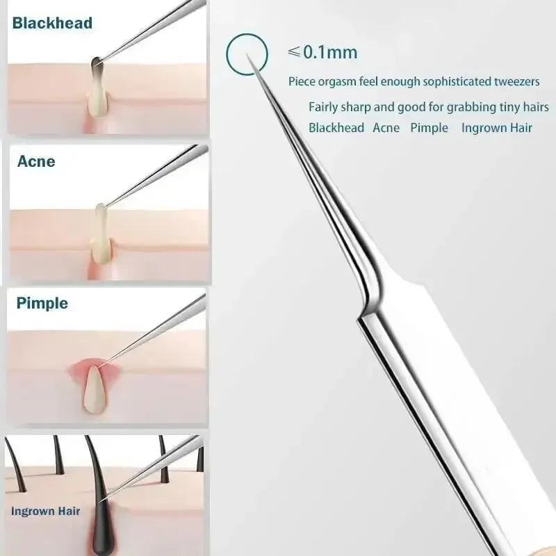 11pcs Acne Blackhead Removal Needles Kit Black Spot Blemish Pimple  Needle Deep Cleansing Tool Face Skin Care Stainless Steel
